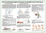 Реабилитация после инсульта