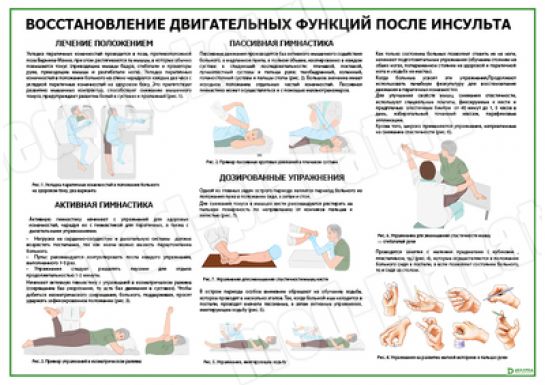 Реабилитация после инсульта