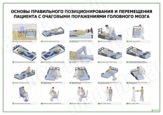 Основы правильного позиционирования и перемещения пациента с очаговыми поражениями головного мозга