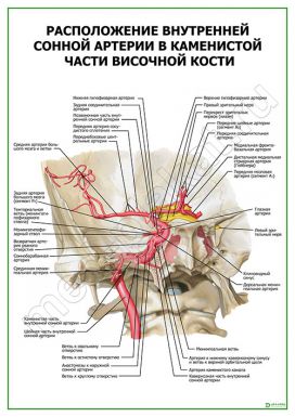 Расположение внутренней сонной артерии в каменистой части височной кости