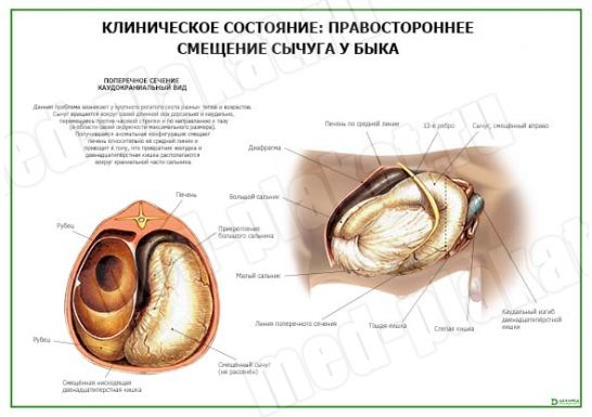 Клиническое состояние: Правостороннее смещение сычуга у быка