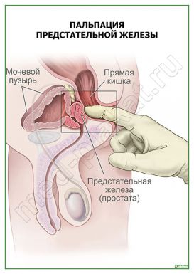 Пальпация предстательной железы