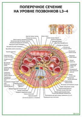 Поперечное сечение на уровне L 3-4