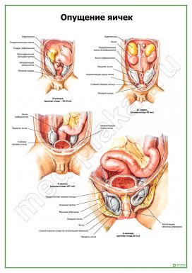 Опущение яичек