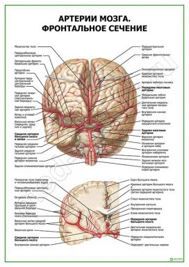 Артерии мозга. Фронтальное сечение